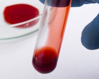 Victims of the contaminated blood scandal win ruling to seek damages