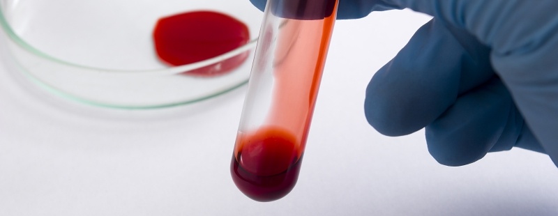 Victims of the contaminated blood scandal win ruling to seek damages