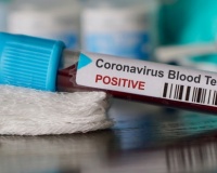 Coronavirus: Employer’s duties and Employee rights