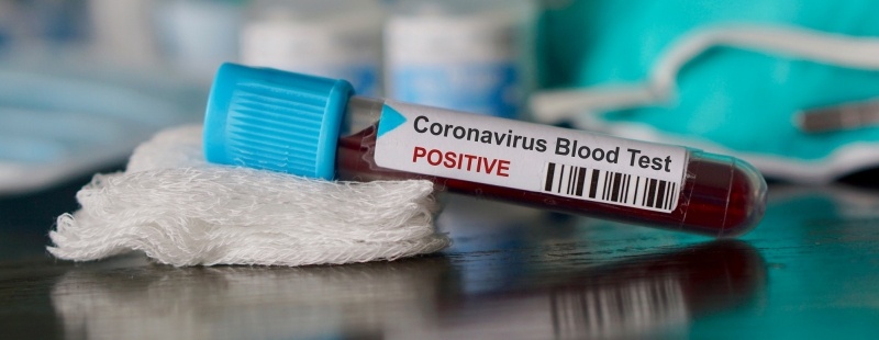 Coronavirus: Employer’s duties and Employee rights